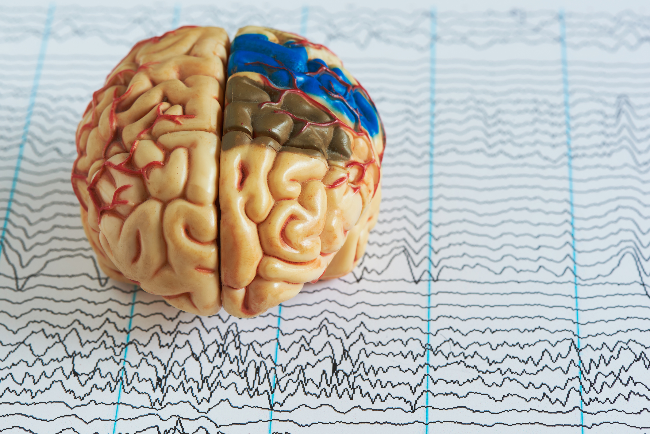 Brain Mapping